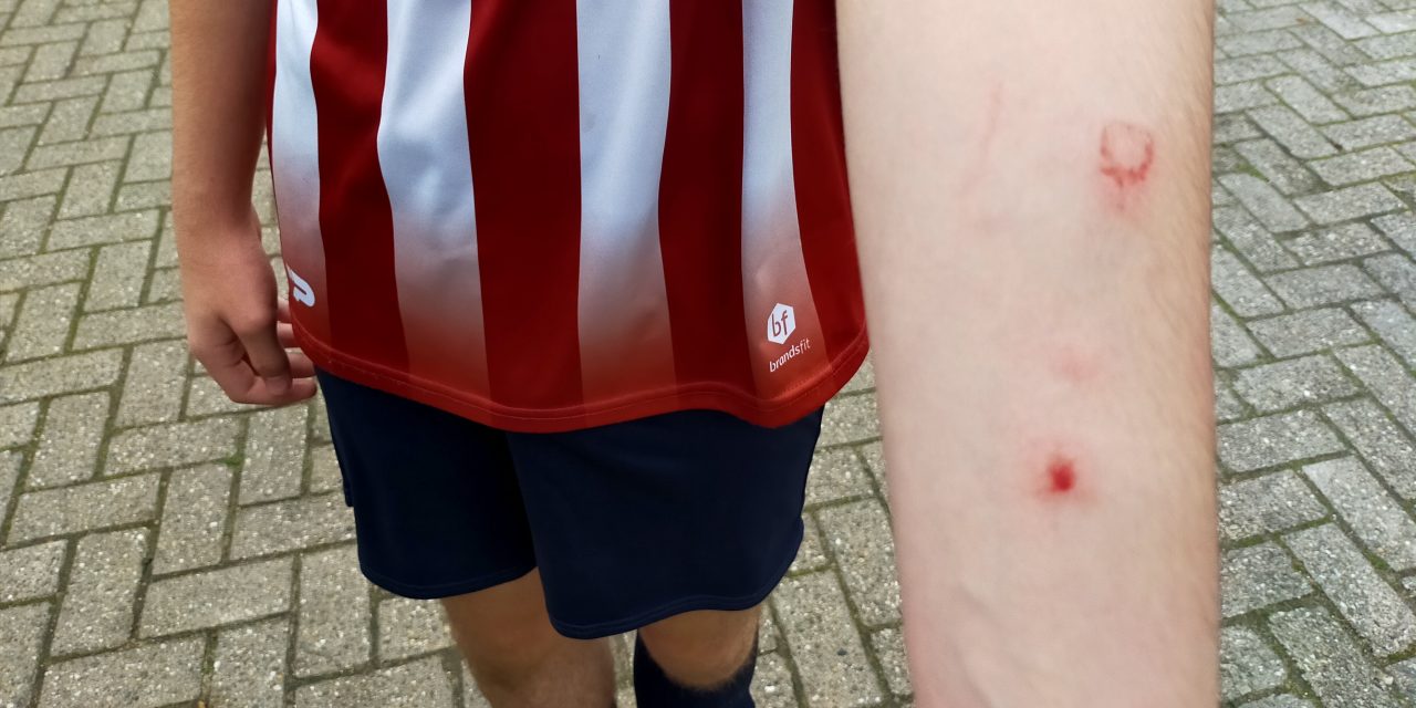 Jo15-2 zoekt supporters